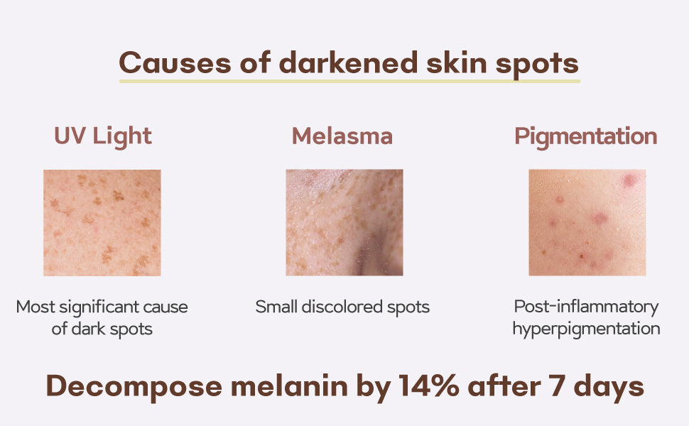 Diagram showing causes of darkened skin spots with images and text.